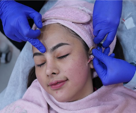 Skin Booster Profhilo